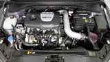 K&N Air Intake (Typhoon Series) 2017-2018 Hyundai Elantra 1.6 Turbo